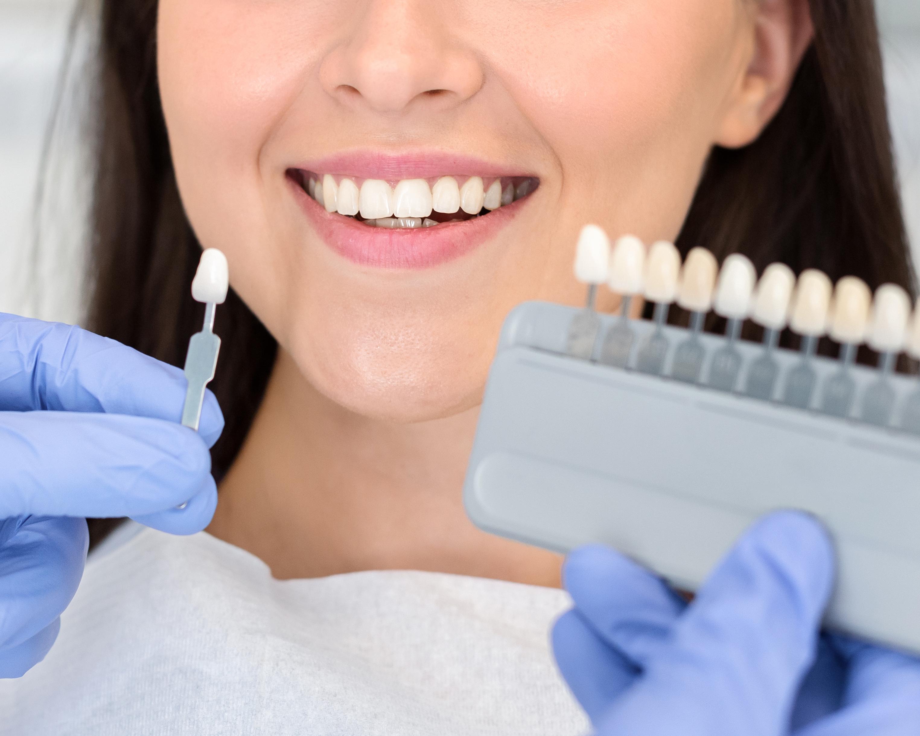 Teeth Whitening Dentist Tawa, Newlands, Porirua, Wellington