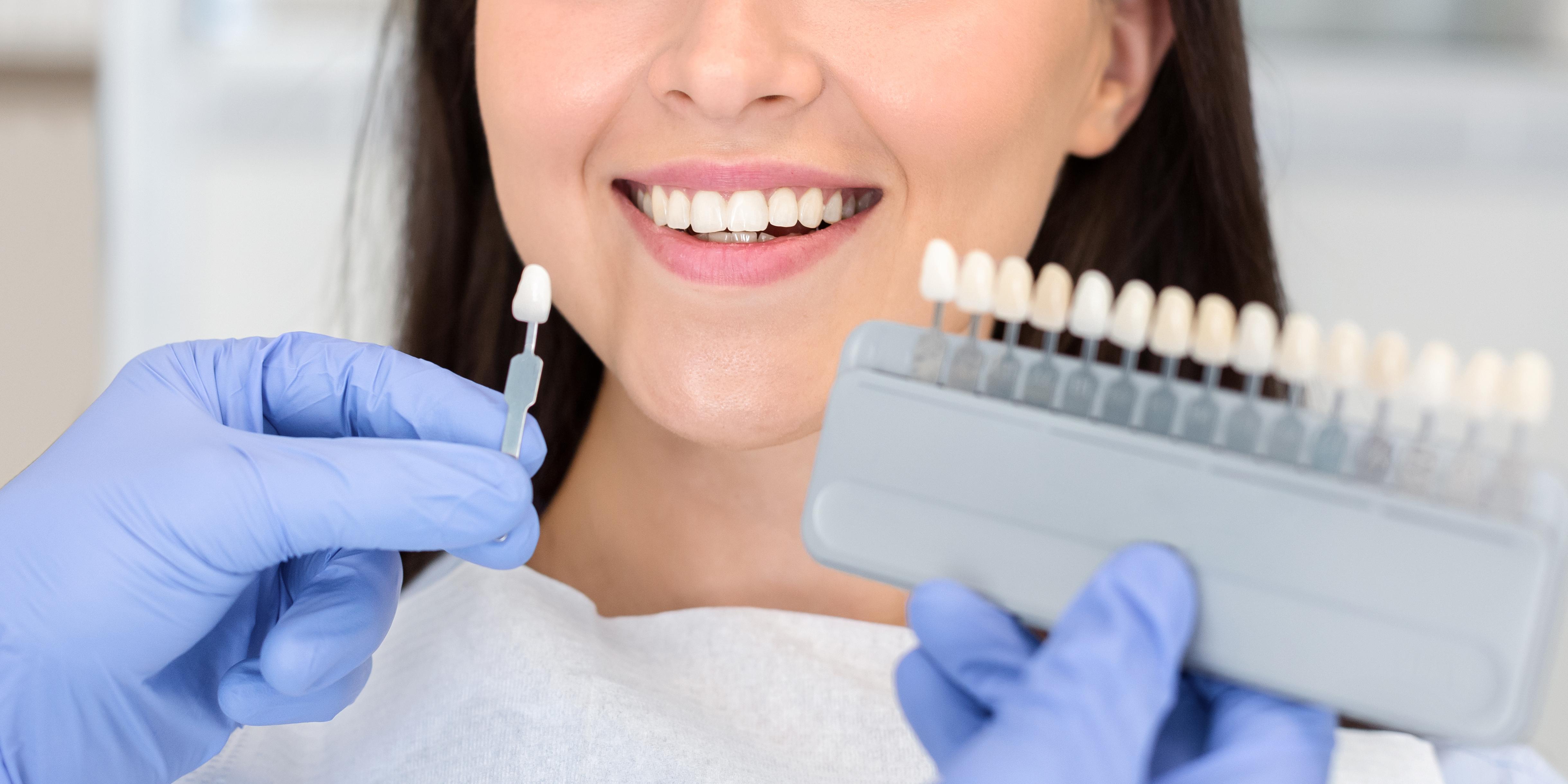 Teeth Whitening Dentist Tawa, Newlands, Porirua, Wellington