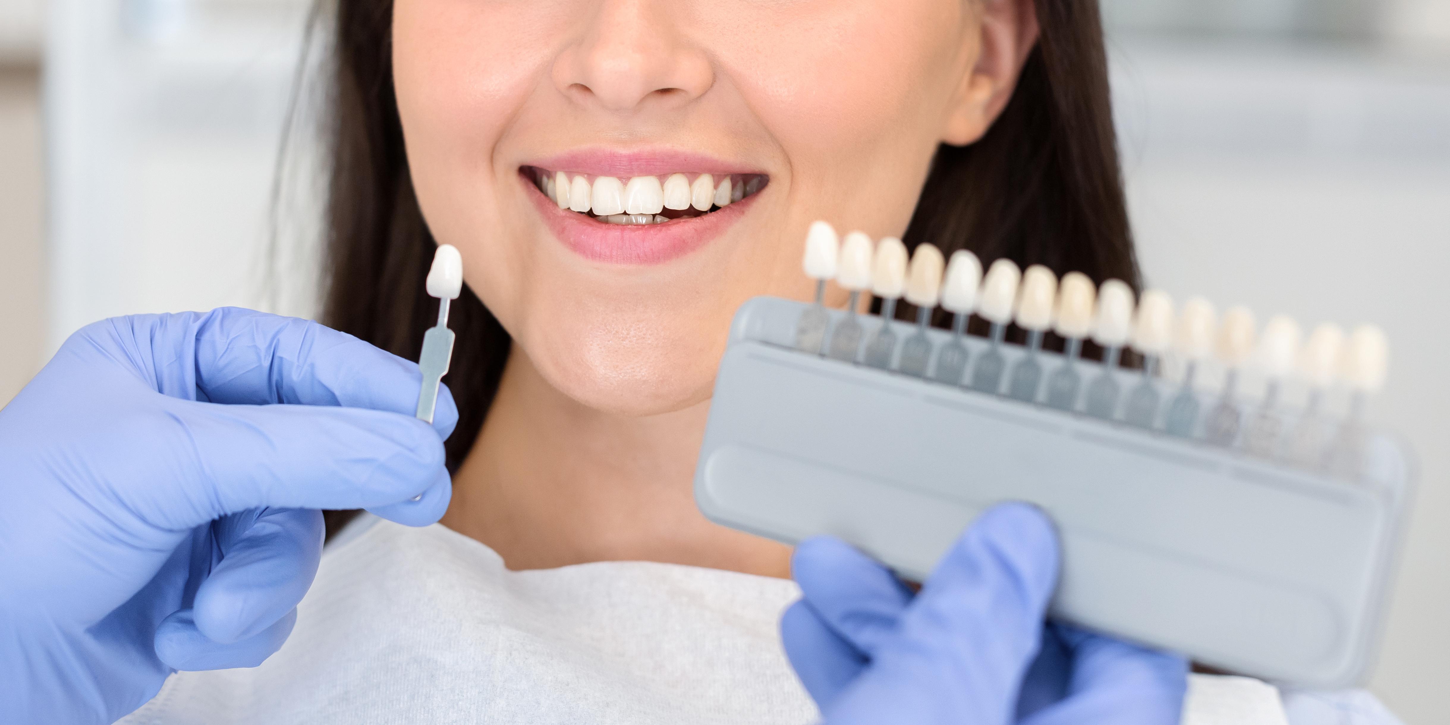 Teeth Whitening Dentist Tawa, Newlands, Porirua, Wellington